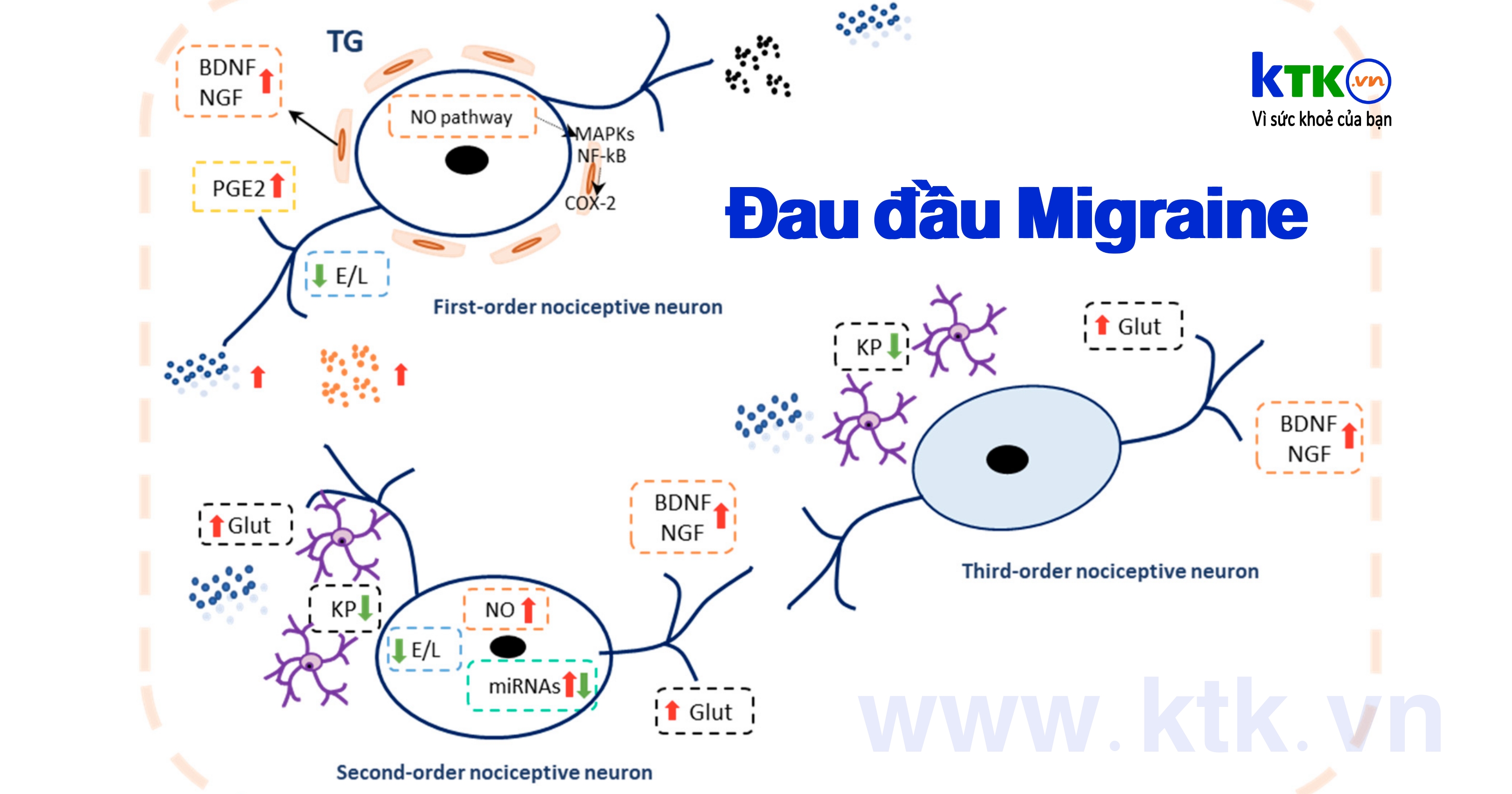 Dấu ấn sinh học liên quan đến đau nửa đầu.